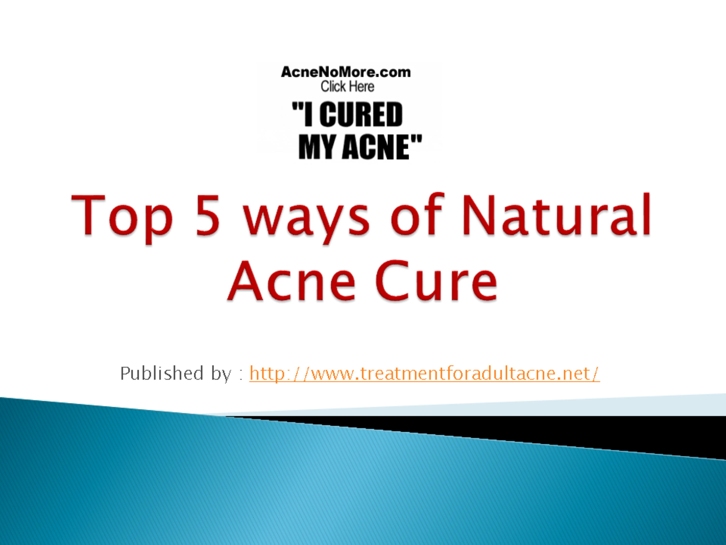 Top 5 ways of Natural Acne Cure.pptx